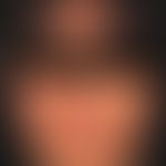 Lupus erythematodes chronicus discoides. Chronische mäßig indurierte Plaques, randlich mit entzue...