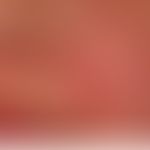 Zoophile Tinea faciei: Detailaufnahme
