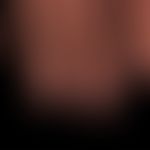 Tinea unguium:almost complete onychodystrophy of all fingernails; patient with insulin-dependent ...