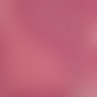 Muir-Torre-Syndrom. Detailvergrößerung: Unterschiedlicher Ausreifungsgrad der epithelialen Zellen...