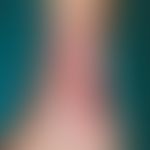 venous leg ulcer. chronic, sharply defined ulcer in the region of the medial aspect of the right ...