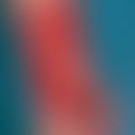 Venous leg ulcer. large ulcer surrounding the distal third of the lower leg and the region of the...