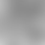 UV-Strahlen. Elektronenmikroskopie: Melanozyten (M) in der basalen Epidermis (E) und im Corium na...