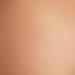 Varizellen:&nbsp;generalisiertes Exanthem mit Nebeneinander von Vesikeln, Papeln, Papulopusteln i...
