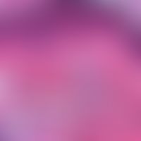 Vaskulitis, leukozytoklastische (non-IgA-assoziierte). Detailaufnahme: (Noch)intaktes Epithel mit...