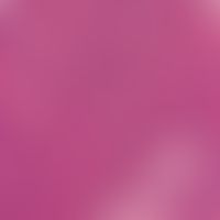 Verruca seborrhoica. acanthotic type with basaloid cell differentiation (small, compact cell type...