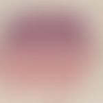 Verruca seborrhoica. acanthotic type. broad-based, exophytic tumor, no infiltrating growth; appea...