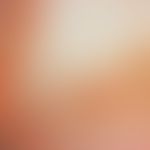 Xanthomatosis, generalized, flat. seeding of small, yellowish papules in the area of the upper ar...