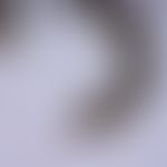 Ticks: Shield tick: Haller's organ: On the upper side of the last foreleg limb lies this olfactor...