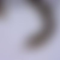 Zecken:&nbsp; Schildzecke: Hallersches Organ. Auf der Oberseite des letzten Vorderbeingliedes lie...