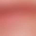 Peutz-Jeghers syndrome. DD: solar lentiginosis of the lip. lentigines acquired in late age are sm...
