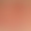 Photoprovocation test. overview image: Positive UVA photoprovocation area on the dorsal skin of a...