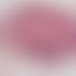 Pilomatrixom: gut abgegrenzter zystischer Tumor im Korium mit breiter basaloider Epithelschicht. ...