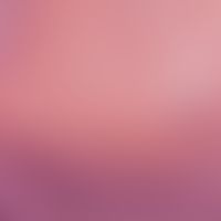Pilomatrixom-Detailvergrößerung: basaloide Außenzellschicht. Zum Zentrum verdämmende eosinophile ...