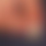 Pincer-nail: röhrenförmige Querverbiegung des Großzehennagels mit Einschneiden in das Nagelbett. ...