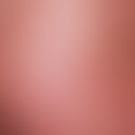 Pityriasis lichenoides chronica. Nahaufnahme, bis 4 mm große, exkoriierte oder ulzerierte hämorrh...