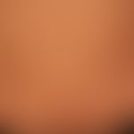 Pityriasis rosea: discreet macular or plaque-shaped exanthema with tender red spots and plaques a...