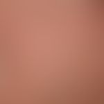 Piytriasis rubra pilaris: Nappes claires
