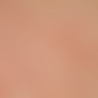 Malasseziafolliculitis: Detail magnification: Disseminated, follicle-bound, inflammatory, 0.5-3 m...