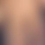 Porphyria cutanea tarda. Hier abgebildet ist eine Detailaufnahme der Hand bei insgesamt generalis...