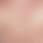 Prurigo simplex subacuta:generalized, permanent clinical picture with disseminated, 0.2-0.5 cm la...