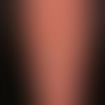 Prurigo simplex subacuata: typicaldistribution pattern of the interval-like itchy, scratched, inf...