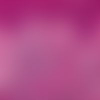 Pseudolymphome der Haut. Breite Akanthose der Epidermis; dichtes knotiges lymphozytäres Infiltrat...