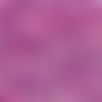 Pseudolymphome der Haut. Polymorphes Infiltrat aus reifen Lymphozyten, Histiozyten und eosinophil...