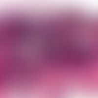 Pseudorecidive, epithelial. pseudoepitheliomasous proliferation of the surface and deep epitheliu...