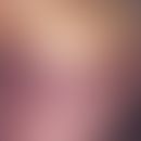 Purpura fulminans: im Abdominalbereich beginnende Purpura fulminans im Rahmen einer Meningokokken...