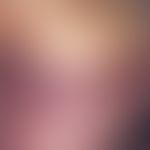 Purpura fulminans: Purpura fulminans beginning in the abdominal region in the context of E. coli ...
