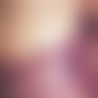 Purpura fulminans: blasige Abhebung der Haut im Bereich der linken Flanke.

