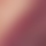 Purpura fulminans - reflected light microscopy (focus in the abdominal area, section): As a resul...