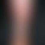 Purpura jaune d'ocre. Flächenhafte Hyperpigmentierung mit einzelnen Stauungsblutungen (Purpura ja...