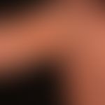 Purpura pigmentosa progressiva. discrete blurred red to red-brown spots. slight itching. occurs a...