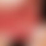 Pyostomatitis vegetans. Multiple, stecknadelkopfgroße bis kleinfingernagelgroße, schmerzhafte, st...