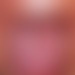 Reiter's syndrome: pronounced lingua plicata; during a relapsing activity, tongue burning with re...