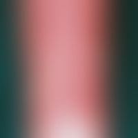 sarcoidosis. small-nodular, disseminated sarcoidosis in a 45-year-old man. development of the dep...