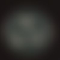 Candida albicans. Kulturoberseite: Anzucht auf selektivem, modifiziertem (Cycloheximid, Chloramph...