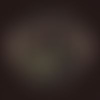 Candida albicans. Anzucht auf Chrom-Selektiv-Agar (Beckton Dickinson BBL CHROMagar Candida) bei 2...
