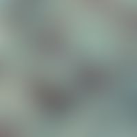 Geotrichum candidum. Detailvergrößerung: Septierte Hyphen und Arthrosporen; Stuhl; GMS-Färbung (P...