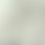 Pityrosporum. microscopy native ("tesa break"):Pityrosporon spp. is the only human pathogenic yea...