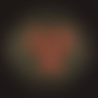 Rhodotorula rubra. Kulturoberseite: Anzucht auf unselektivem Kimmig-Agar. Schnelles Wachstum (2-4...