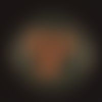 Rhodotorula&nbsp;mucilaginosa.&nbsp;Kulturunterseite: dunkelorange bis rote Farbe. Scharfe Begren...