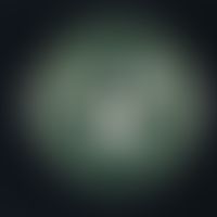 Trichophyton verrucosum, cultivated on selective, modified (cycloheximide, chloramphenicol) cinna...