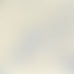 Trichophyton mentagrophytes. branched hyphae, typical spiral hyphae (missing in the picture) ofte...