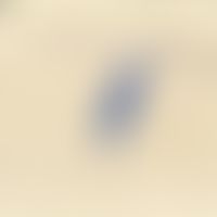 Microsporum canis. Detailvergrößerung: Typische, spindelförmige, mehrkammerige Makrokonidie mit s...