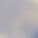Microsporum canis. Typische Mikroskopie einer körnigen Kultur: Viele feine lange Hyphen und Makro...