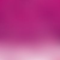 AIN. AIN I: Ausschnittsvergrößerung; gut abgegrenzte Basalmembran; mehrere dyskeratotische Kerati...