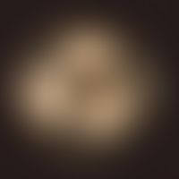 Aspergillus fumigatus. Kulturoberseite: Anzucht auf unselektivem Kimmig-Agar.  Schnelles Wachstum...